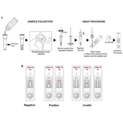 Hướng dẫn sử dụng Kit test nhanh Genbody